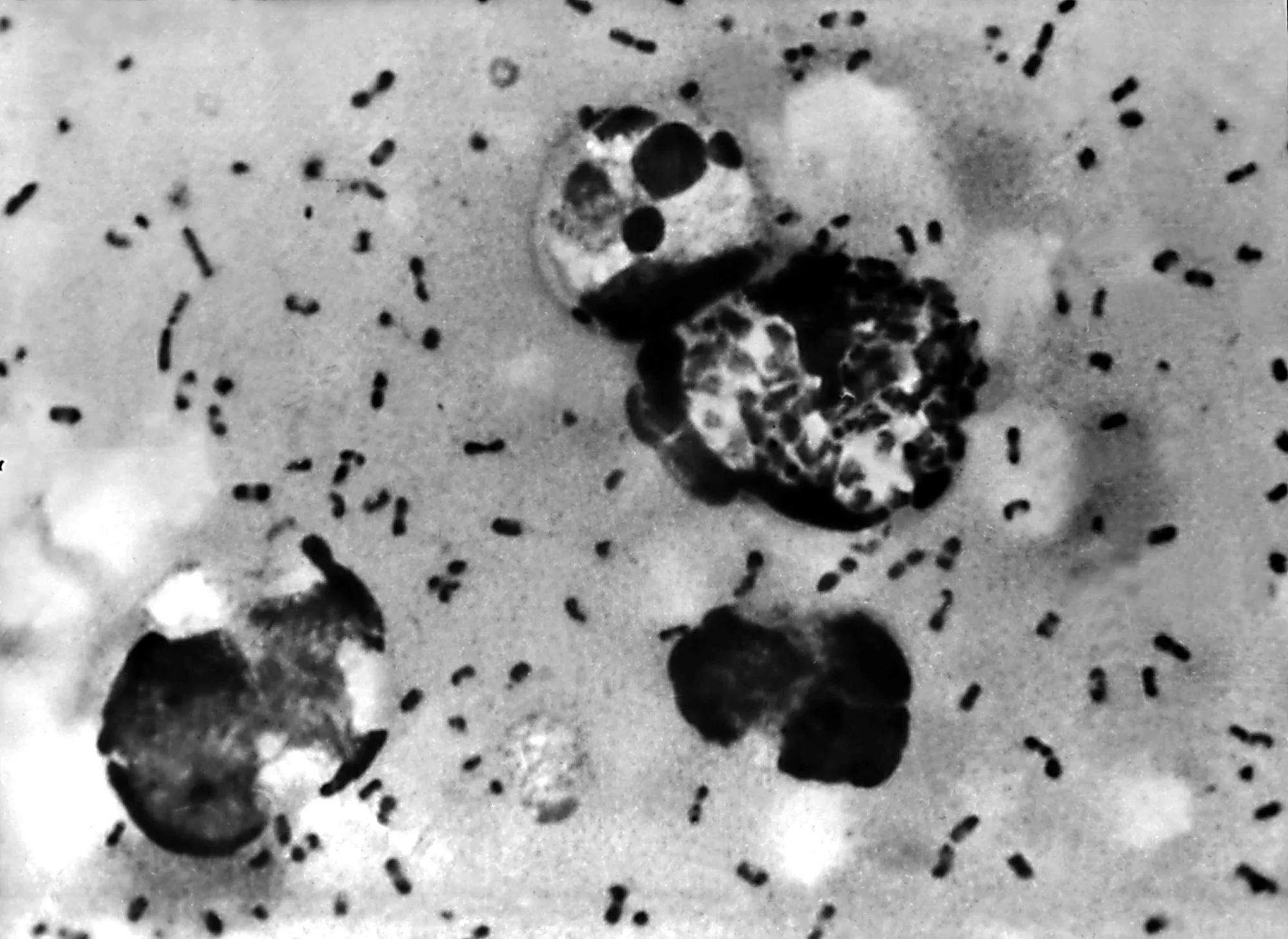 Bubonic plague&nbsp;