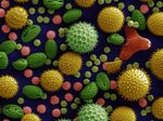 An electron-microscope view of pollen from common plants.