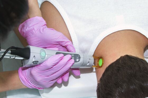 New York Tries to Rein In the Laser Hair Removal Industry