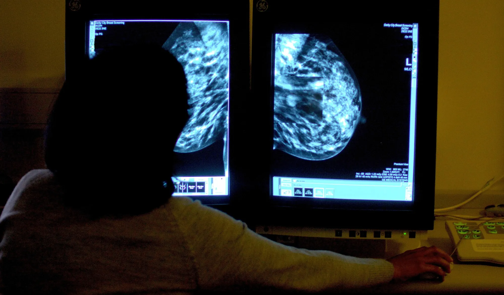 A consultant studying a mammogram