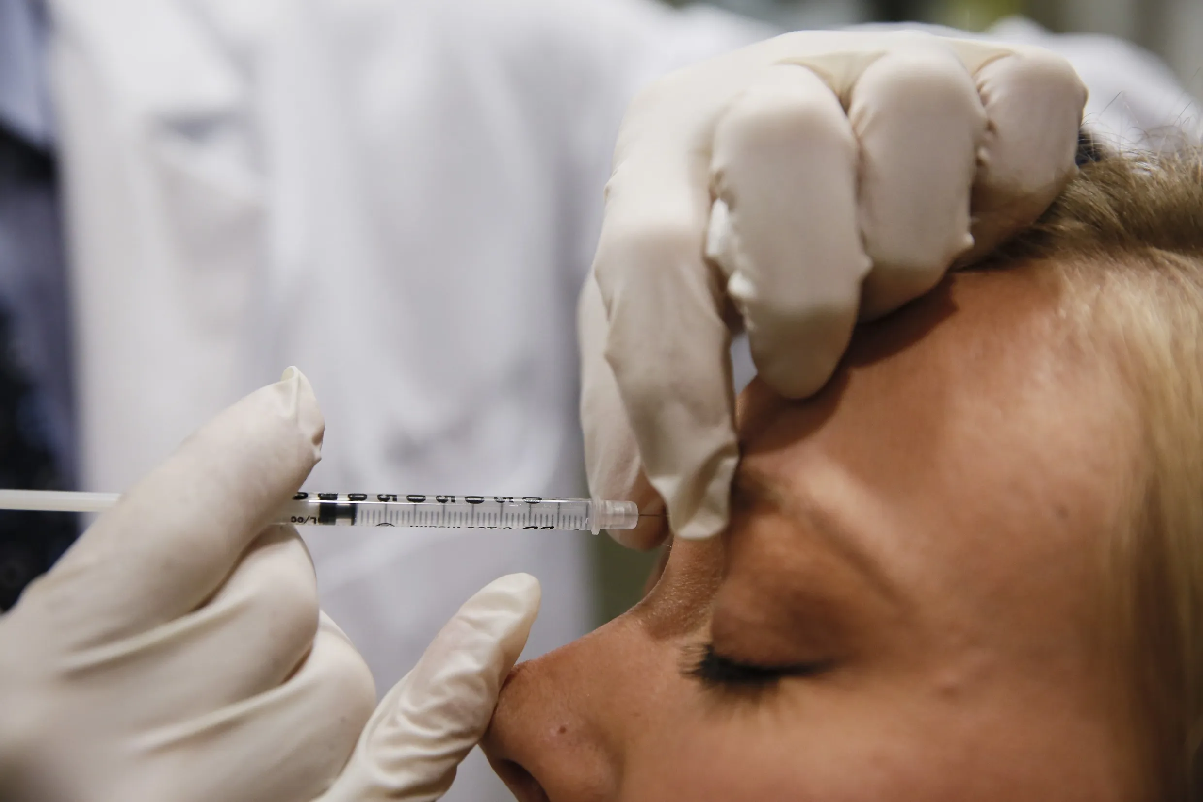 A patient injected with a Botox treatment in Redondo Beach, California