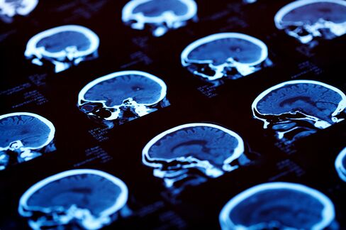 Ancient Human Kin’s DNA Code Illuminates Rise of Modern Brains