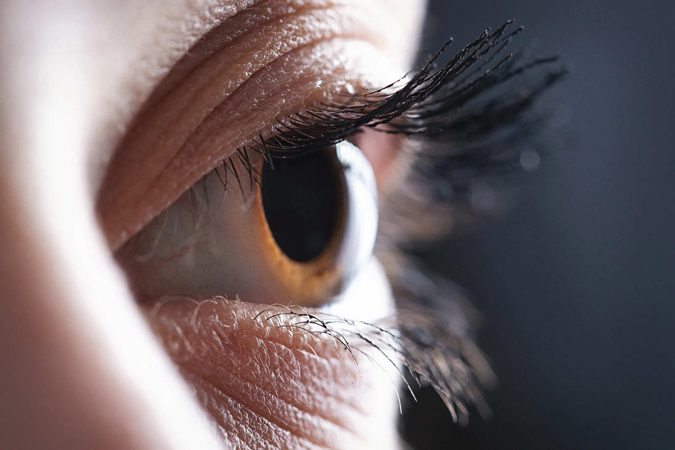 Eye