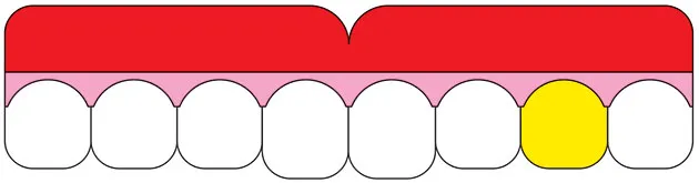 The Dental Index Suggests Economic Pain Ahead