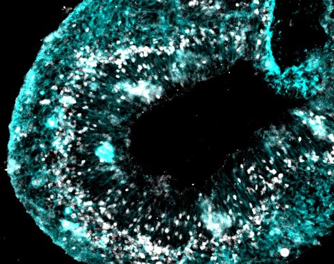 Researchers generated this “brain in a dish” from induced pluripotent stem cells after coaxing them to become neurons.