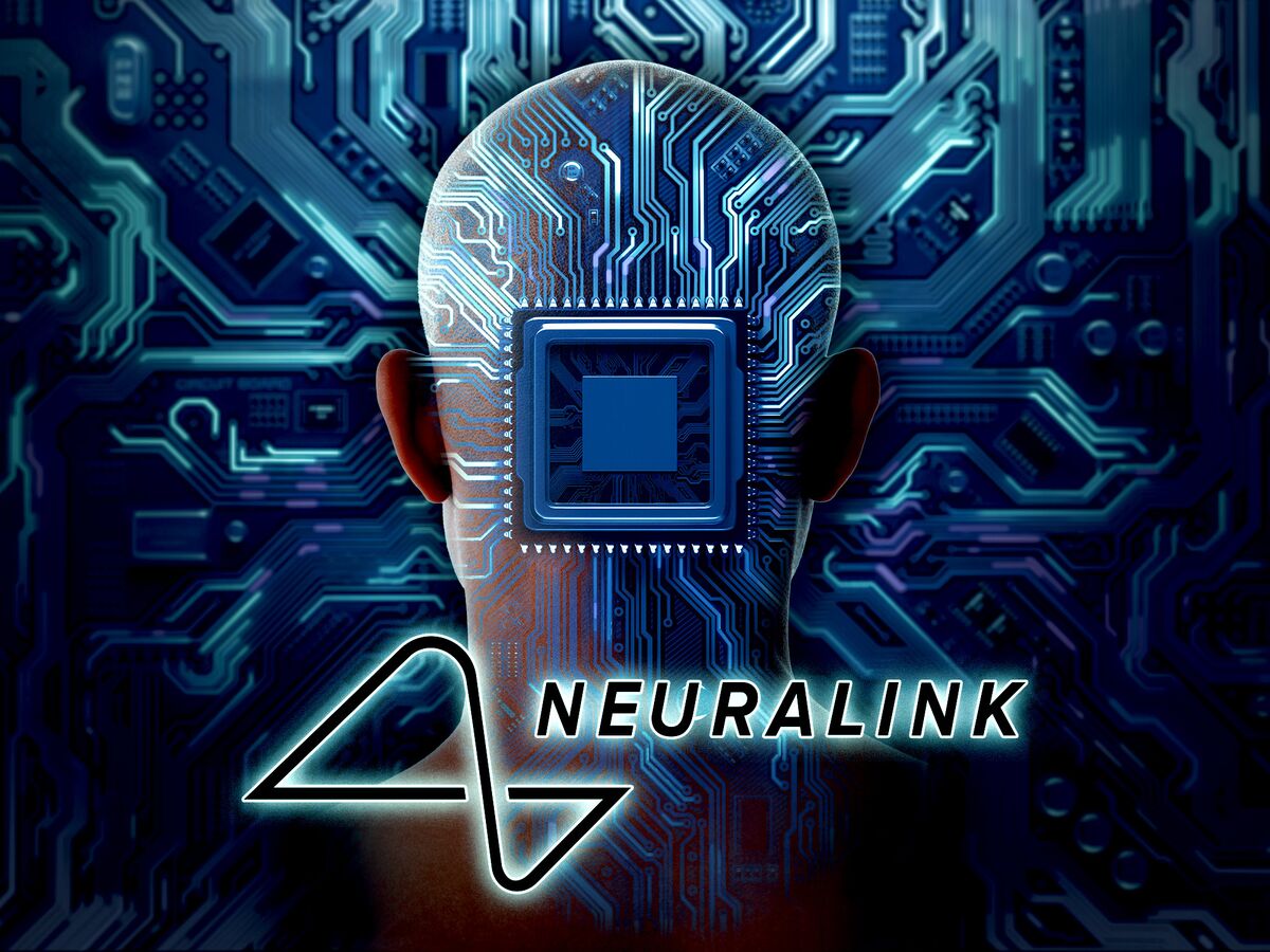 Musk: Primer Paciente De Neuralink Recibe Implante En Cerebro - Bloomberg