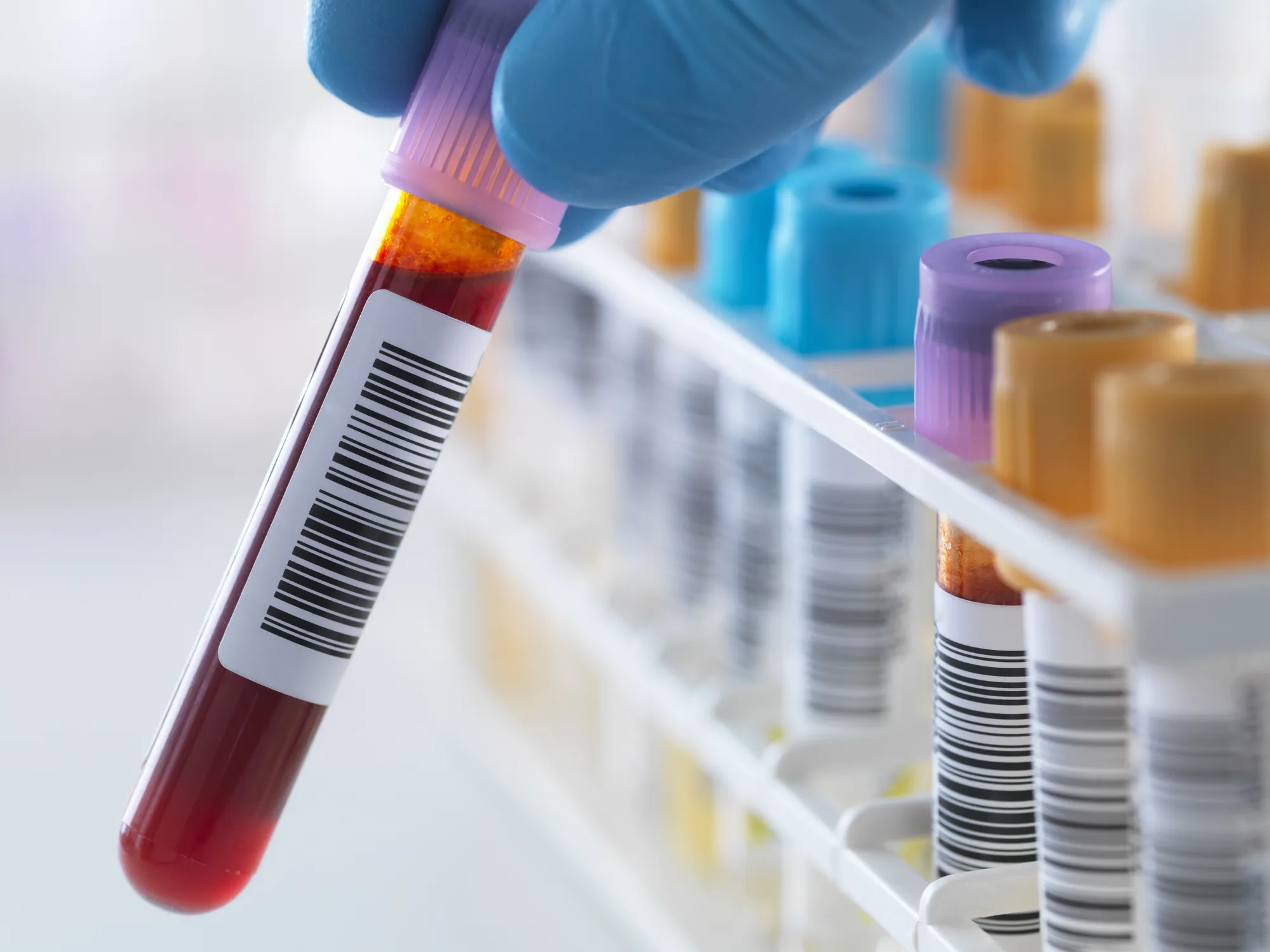 Promising data from Grail Inc. showed its blood test Galleri was able&nbsp;to detect otherwise hard-to-find tumors.