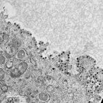 An electron microscopic image of the 2019 novel coronavirus grown in cells at the University of Hong Kong.