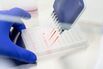 Inside Driver Laboratory as Harvard Doctors Backed by Li Ka-shing Try a Fix For Cancer Care