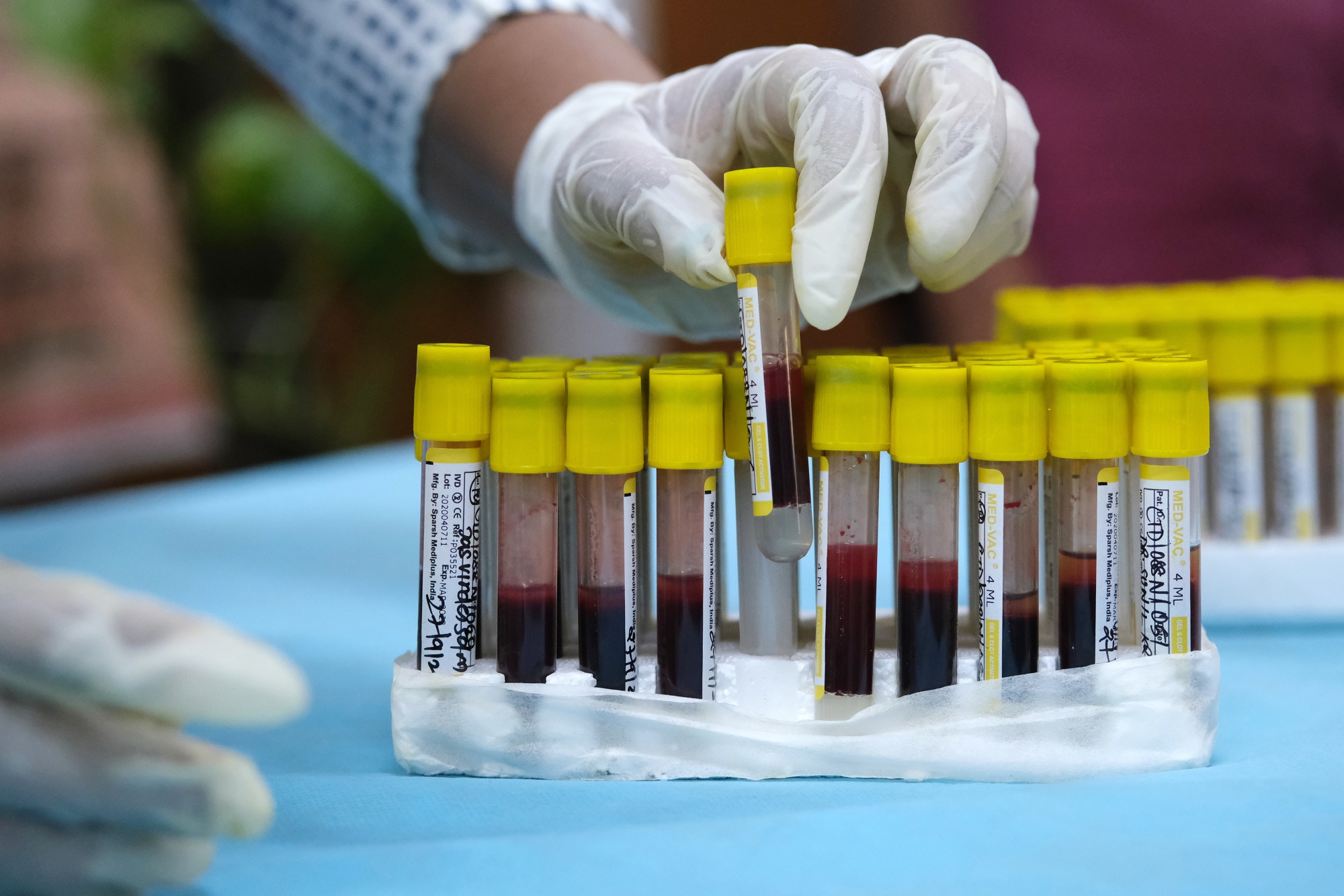 A health worker handles a tray of blood samples in New Delhi, India.&nbsp;