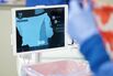 Blood loss is measured with the Triton blood loss monitor.
