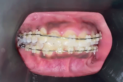 Remote Dentist GIF
