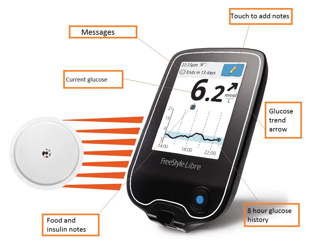 The FreeStyle Libre is the first fingerprick-free glucose-monitoring device approved by U.S. health regulators.