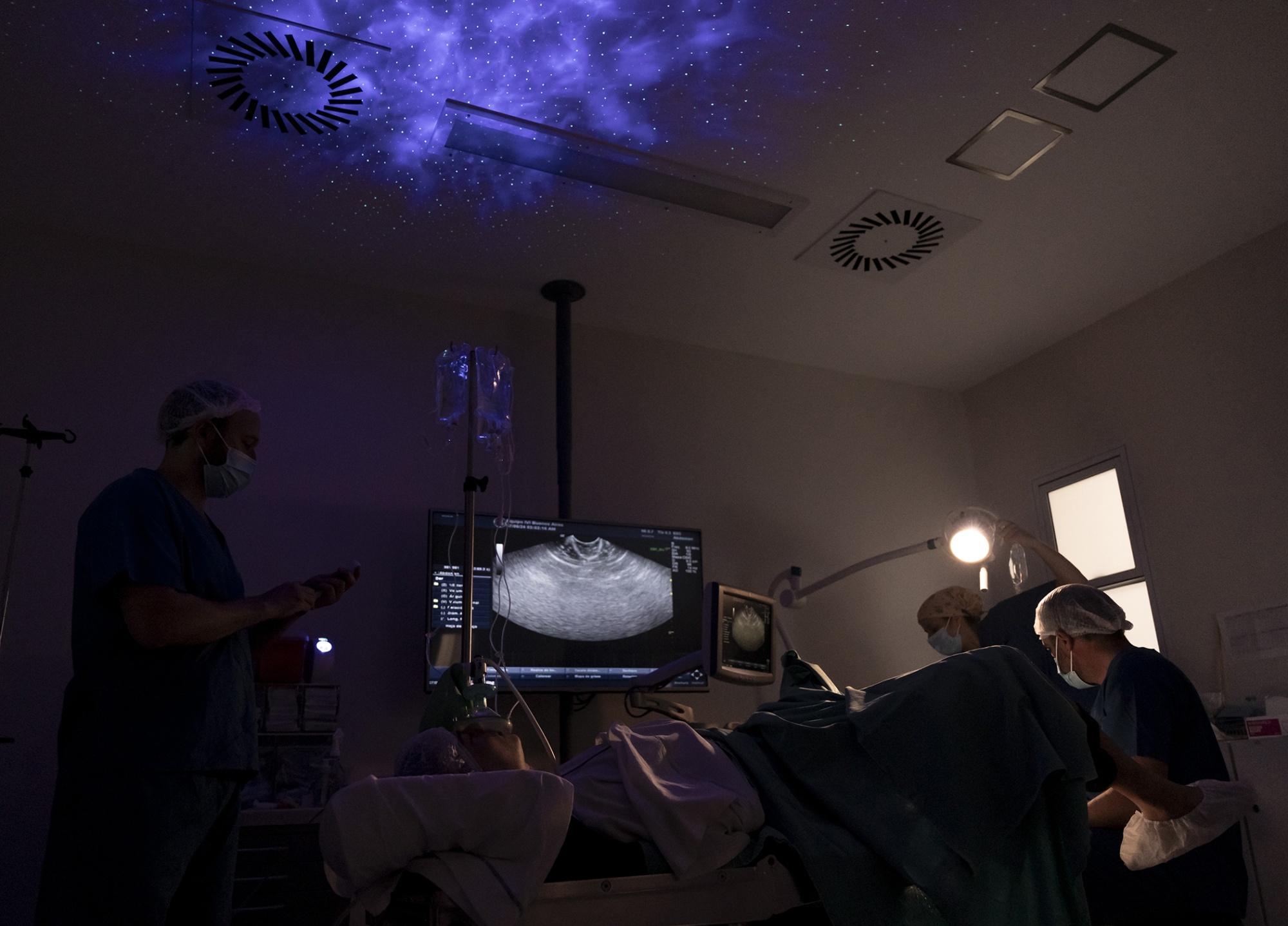 An operating room with a projection of stars on the ceiling and a scan of a woman's ovaries on a screen. Three medical professionals wearing scrubs and caps are in the room and the room is dimly lit.
