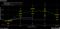 Fed Dot Plot
