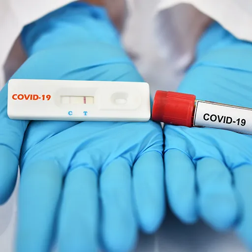 Positive test result by using rapid test device for COVID-19 virus.