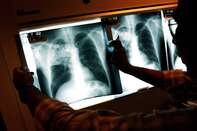 Healthcare Workers Fight TB In The Inner City