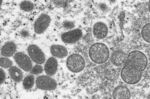 成熟した楕円形のサル痘ウイルス粒子（左）と球状の未成熟ウイルス粒子（右）、2003年の電子顕微鏡画像