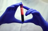 Coronavirus Testing And Lab Research As Germany's New Infections Rise
