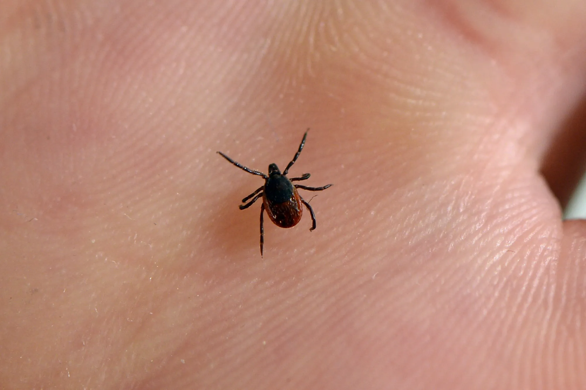 Tiny ticks are very&nbsp;dangerous.