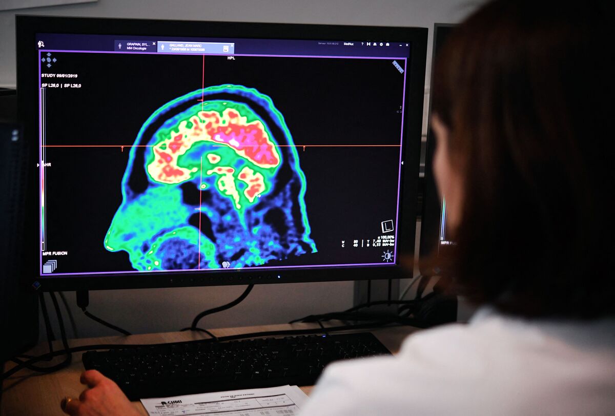 AI blood test could speed up diagnosis of brain tumours, say