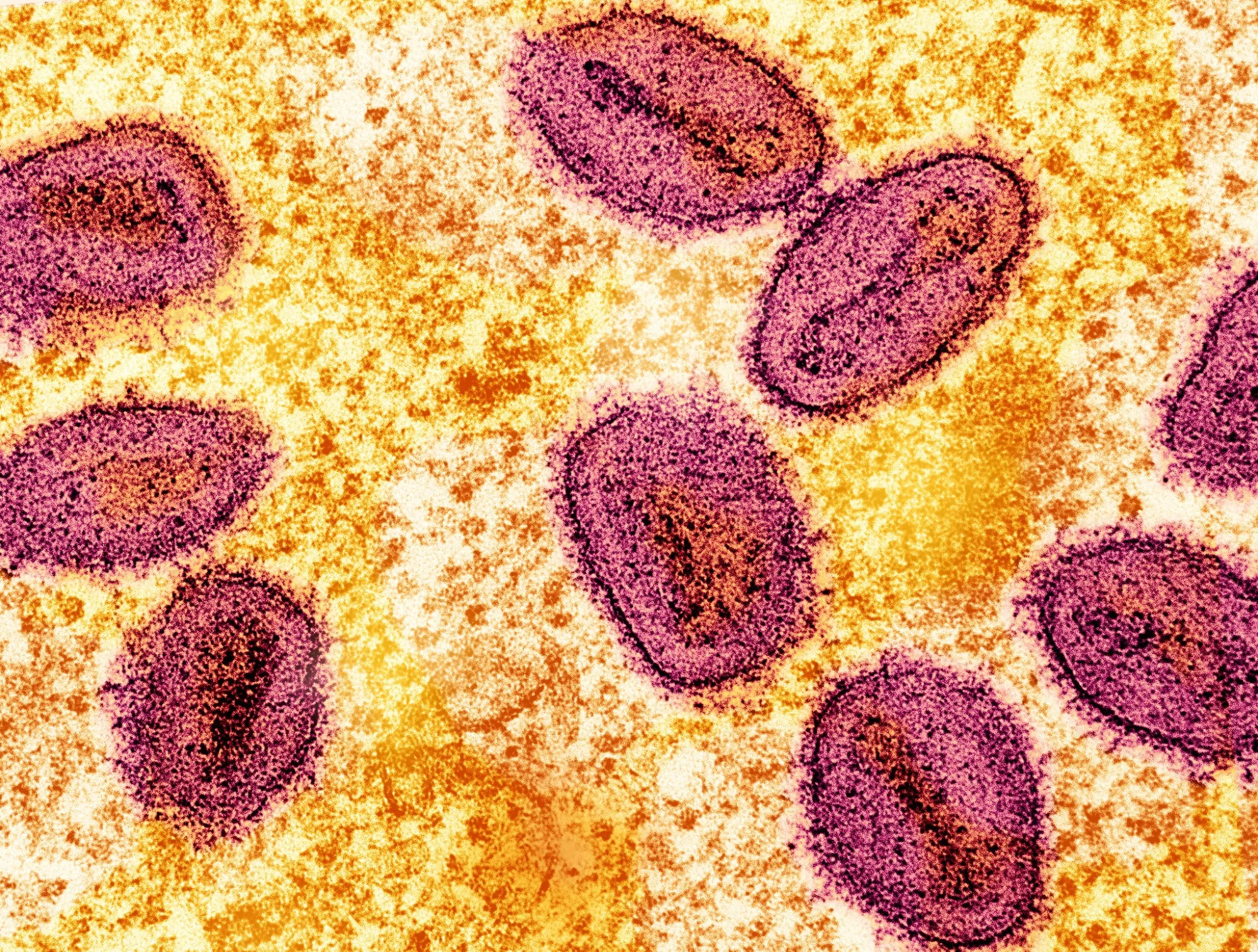 Colorized transmission electron micrograph of mpox virus particles.