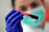 Coronavirus Testing And Lab Research As Germany's New Infections Rise