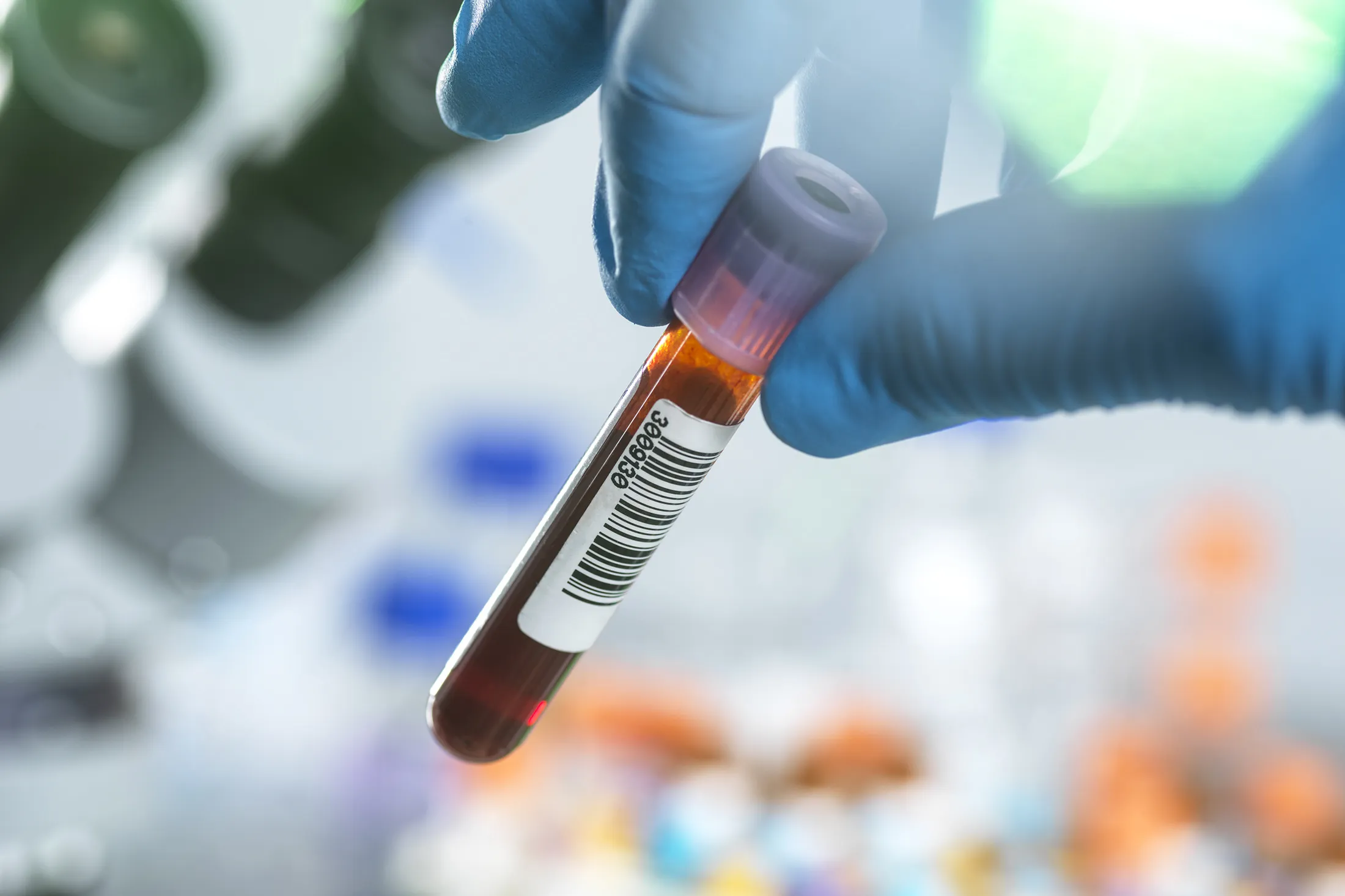 Guardant (GH) Stock Drops as Colorectal-Cancer Test Results Disappoint  Investors - Bloomberg