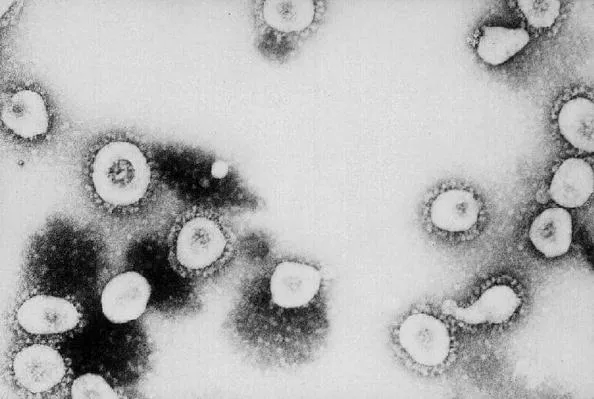 Can the coronavirus lurk in people months after an infection?