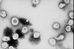 Can the coronavirus lurk in people months after an infection?