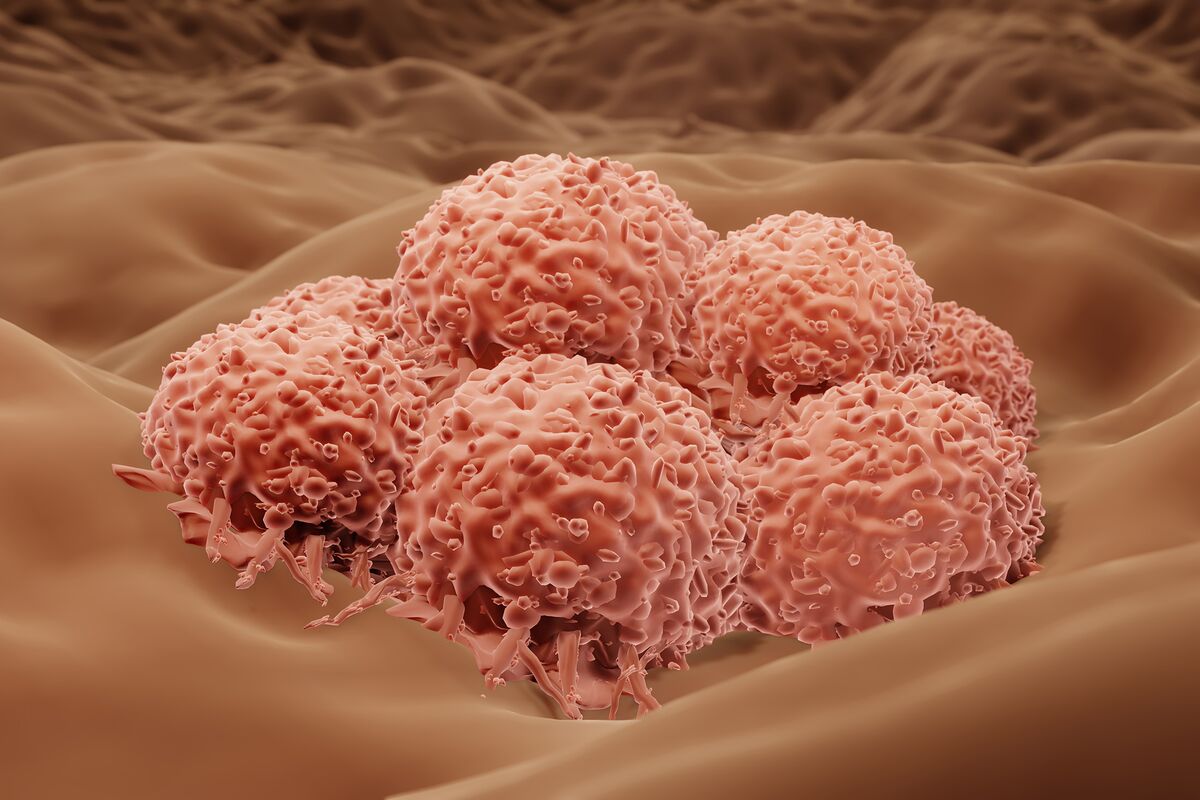 bloomberg.com - Michelle Fay Cortez - When Hardcore Pharma Investors Meet Enthusiastic Oncologists