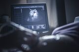 Pregnant woman having sonogram