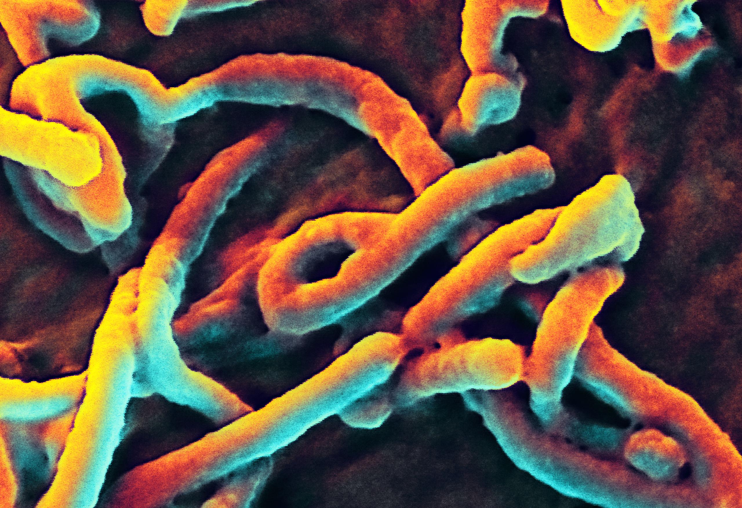Scanning electron micrograph of the Ebola virus. Source: NIAID