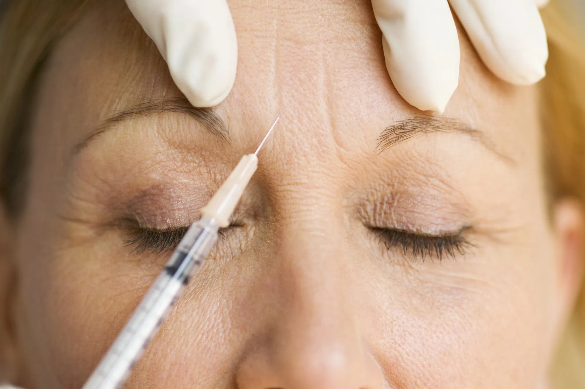 Any potential bond sale would come as demand for cosmetic procedures keeps growing in the US.