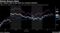 Stocks Bounce Back