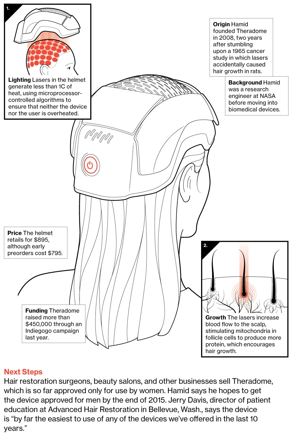 Theradome Helmet Fights Hair Loss With Lasers