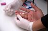 HIV test GETTY Sub
