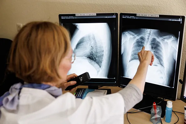 Screening Ukrainian lungs in Germany.