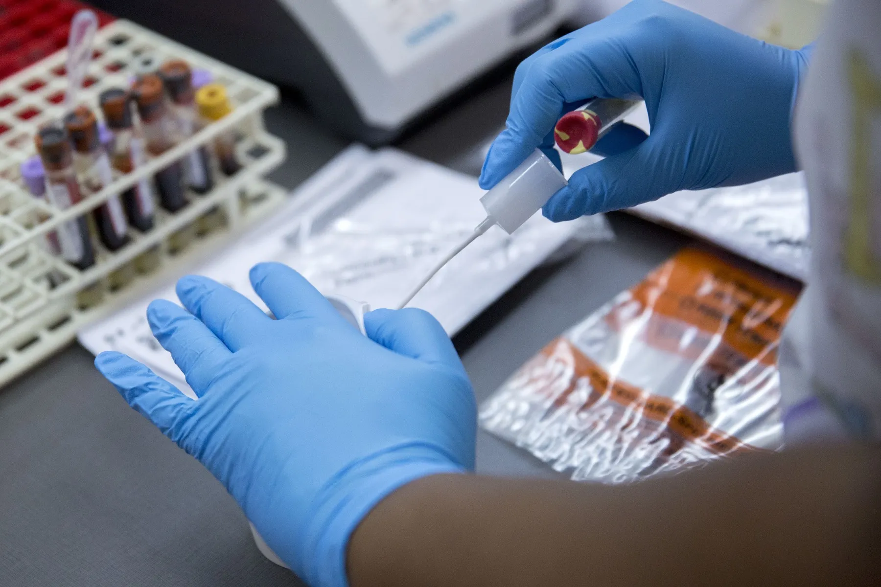 Laboratory Corporation of America Holdings (LabCorp) phlebotomist Shavonne Randolph processes a urine sample at a Community Clinic Inc. health center in Silver Spring, Maryland, U.S.