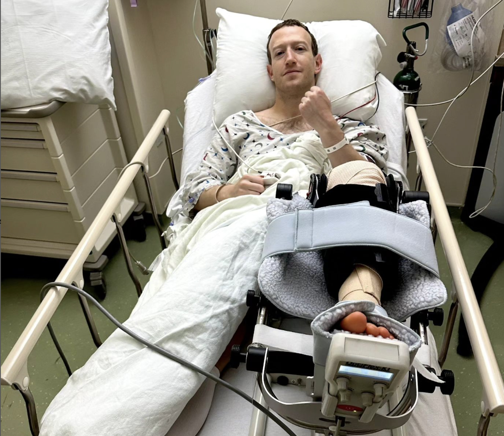 Mark Zuckerberg posted a photo from a hospital bed on his Instagram platform, announcing that he had torn his ACL and had undergone surgery.