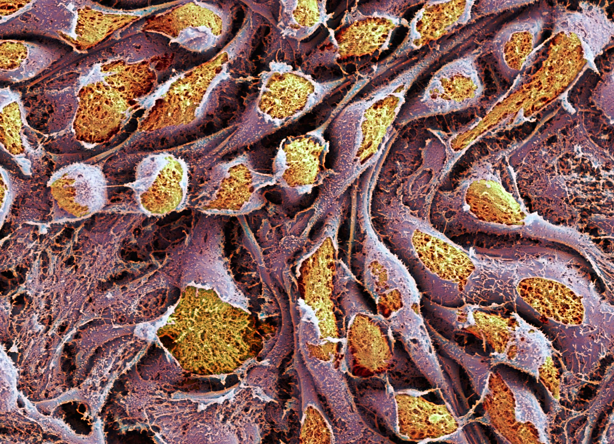 Coloured scanning electron micrograph of human stem cells.
