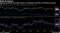 Risk Premium