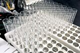 A tray of test tubes sits in a microbiology laboratory at th