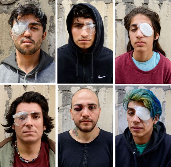Dozens Blinded by Chile Police in Violent Crackdown on Protests