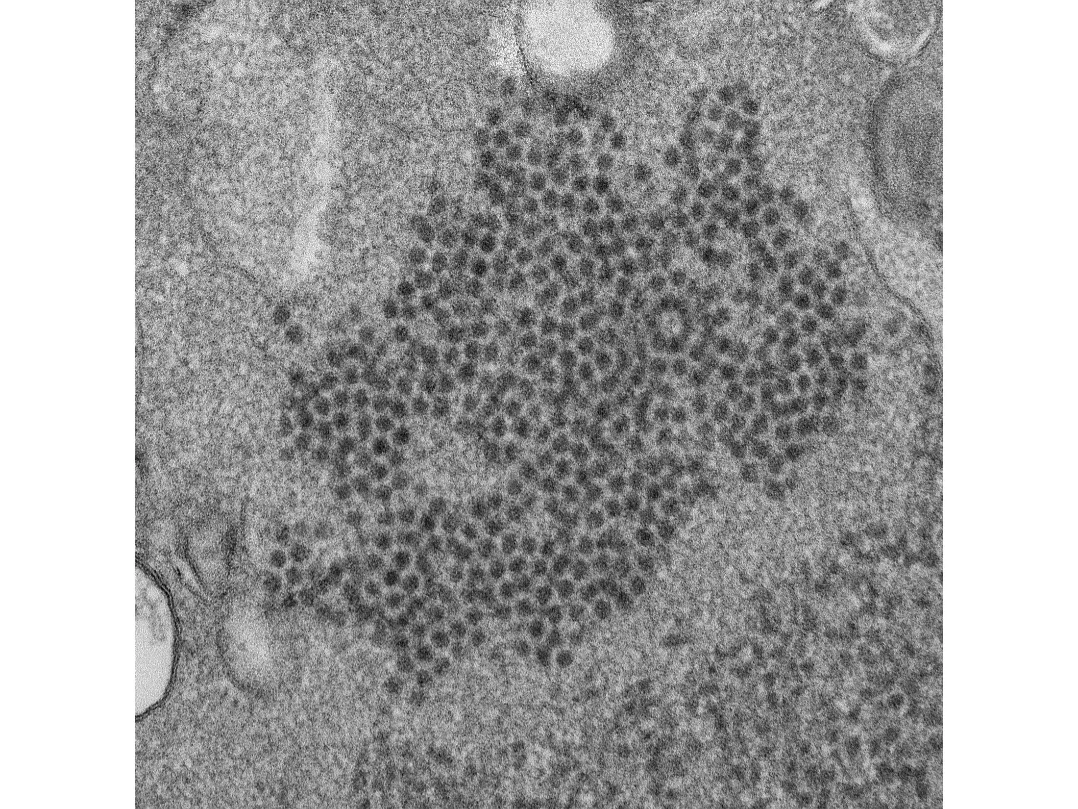 Enterovirus-D68&nbsp;