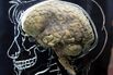 The human brain

