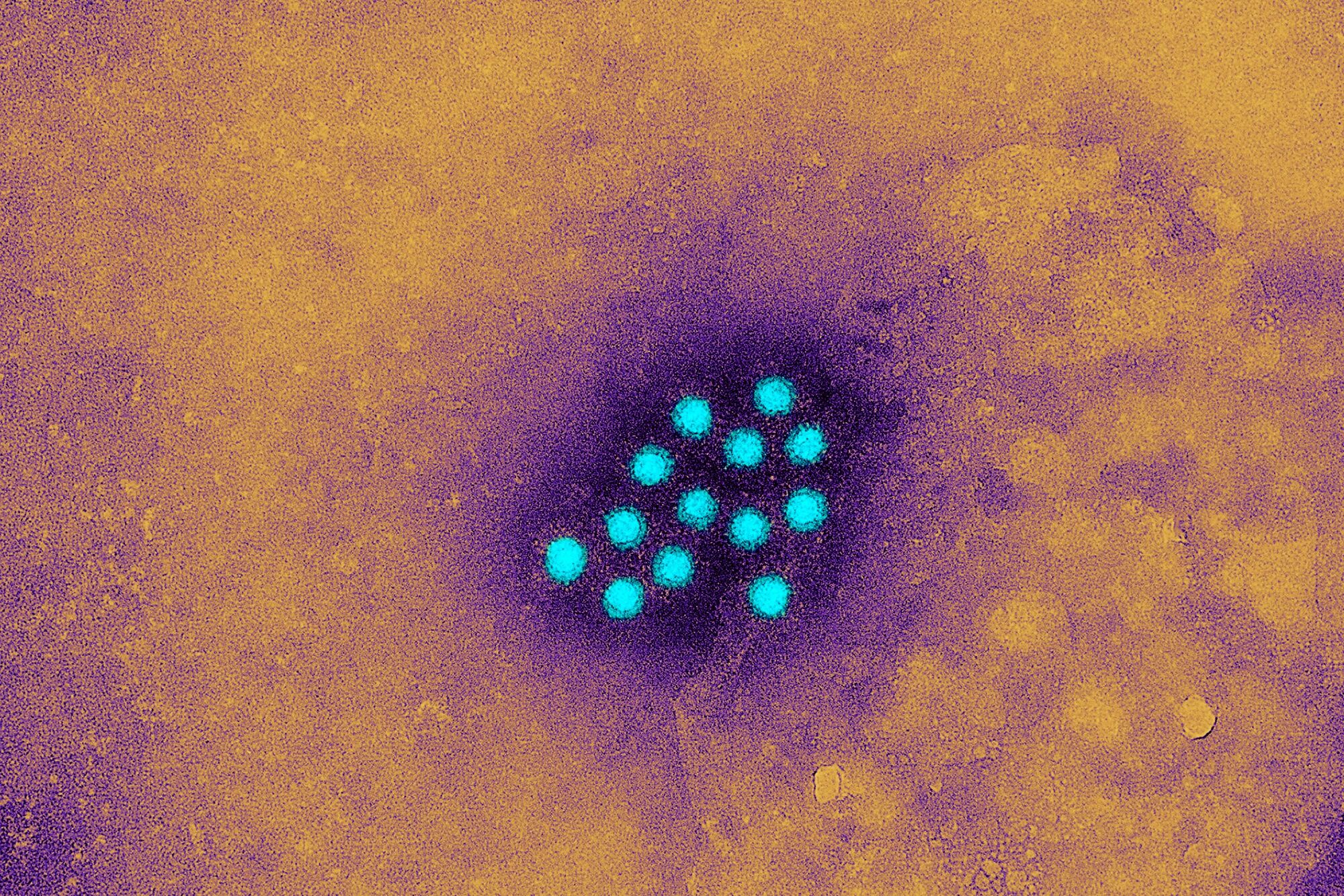 Гепатит бактерии