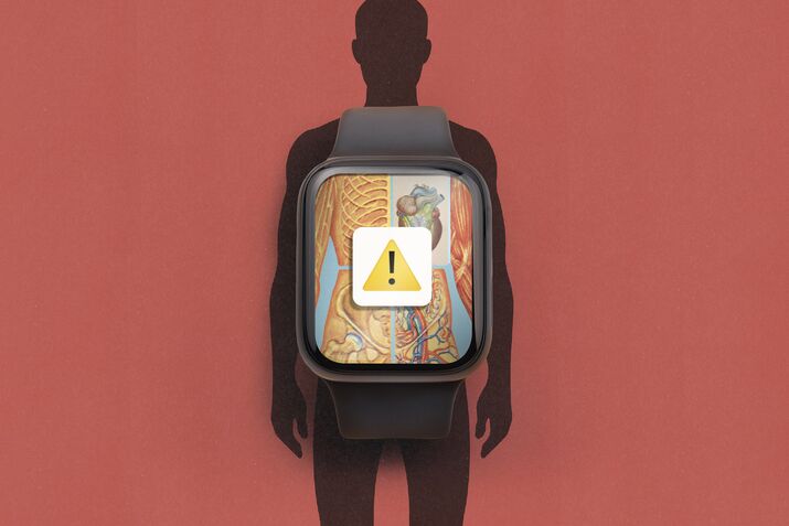 Wearables Increasingly Look to AI to Predict Health Problems Before They Happen