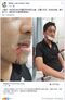 Lam Cheuk-ting Facebook Attack Lip Protest