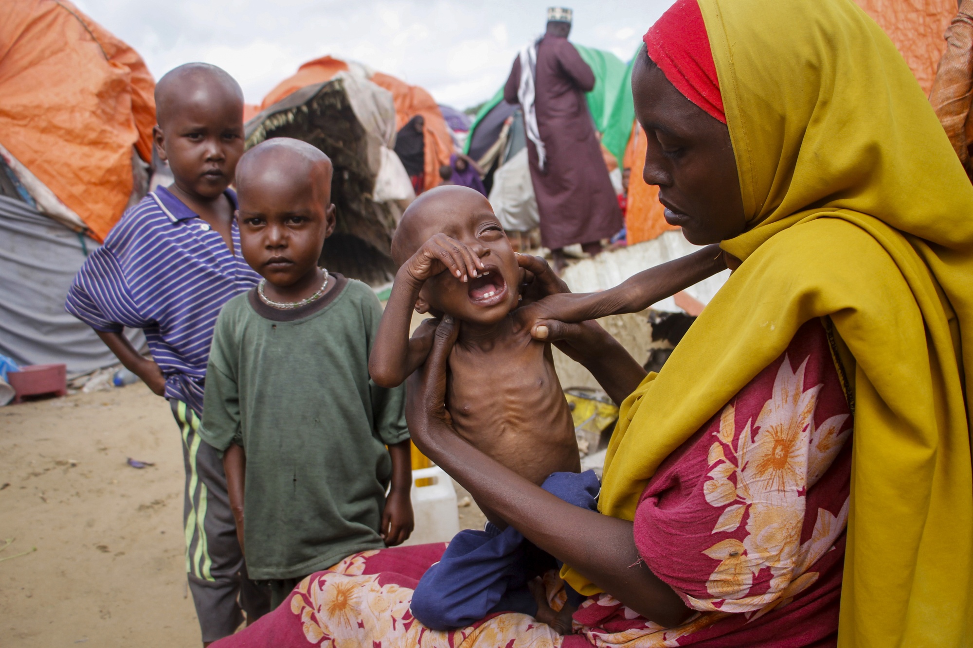 Maryan Madey, who fled the drought-stricken Lower Shabelle region, holds her malnourished daughter Deka Ali, 1, at a camp for the displaced on the outskirts of Mogadishu, Somalia Saturday, Sept. 3, 2022. Millions of people in the Horn of Africa region are going hungry because of drought, and thousands have died, with Somalia especially hard hit because it sourced at least 90 percent of its grain from Ukraine and Russia before Russia invaded Ukraine. (AP Photo/Farah Abdi Warsameh)